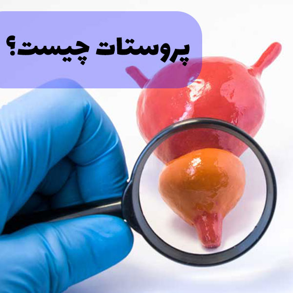 پروستات